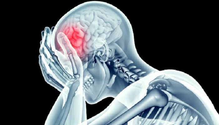 Penting Untuk Diketahui, Ini 5 Penyebab Stroke Ringan 